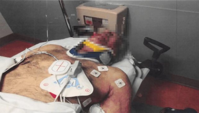 Publikohen FOTOT e para të Epstein pas vetëvrasjes në burg  zbulohen detaje nga autopsia